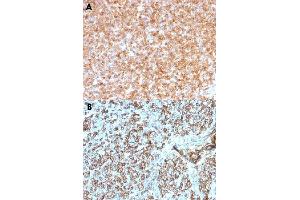 Immunohistochemical staining (Formalin-fixed paraffin-embedded sections) of human tonsil with HLA-DP/HLA-DQ/HLA-DR monoclonal antibody, clone CR3/43 . (HLA-DPB1 抗体)