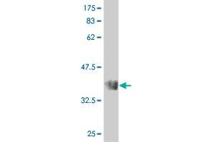 Western Blot detection against Immunogen (66. (STK32C 抗体  (AA 1-369))