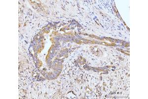 IHC analysis of MAP4K1/HPK1 using anti-MAP4K1/HPK1 antibody (ABIN7601232).