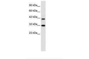 Image no. 1 for anti-D4, Zinc and Double PHD Fingers Family 1 (DPF1) (AA 229-278) antibody (ABIN6735926)