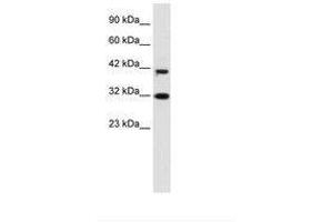 Image no. 1 for anti-D4, Zinc and Double PHD Fingers Family 1 (DPF1) (AA 229-278) antibody (ABIN6735926) (DPF1 抗体  (AA 229-278))