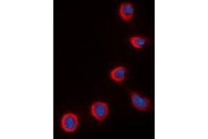 Immunofluorescent analysis of COX4-2 staining in K562 cells. (COX4I2 抗体)