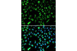 Immunofluorescence analysis of A549 cells using NME1 antibody. (NME1 抗体  (C-Term))