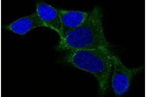 IF staining of LNCap cells using AF488 labeled ODC1 Monoclonal Antibody (ODC1/487) (Green). (ODC1 抗体)