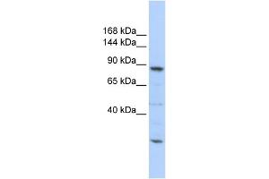 WB Suggested Anti-CDC5L Antibody Titration:  0. (CDC5L 抗体  (Middle Region))