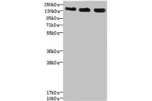 Western blot All lanes: ANKS1B antibody at 5. (ANKS1B 抗体  (AA 999-1248))
