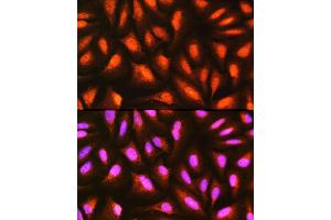 Immunofluorescence analysis of U-2 OS cells using MDFI Rabbit pAb (ABIN6128316, ABIN6143663, ABIN6143664 and ABIN6217803) at dilution of 1:100 (40x lens). (MDFI 抗体  (AA 1-160))