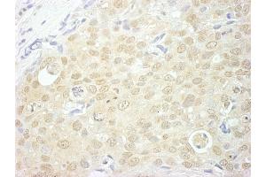 Immunohistochemistry (IHC) image for anti-Nuclear Cap Binding Protein Subunit 1, 80kDa (NCBP1) (AA 1-50) antibody (ABIN7453737)