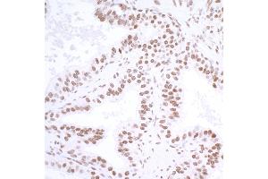 Immunohistochemistry (IHC) image for anti-Ubiquitin Specific Peptidase 7 (Herpes Virus-Associated) (USP7) (AA 1-50) antibody (ABIN7453991) (Recombinant USP7 抗体  (AA 1-50))