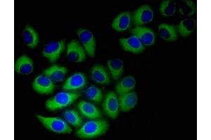 Immunofluorescent analysis of A549 cells using ABIN7161610 at dilution of 1:100 and Alexa Fluor 488-congugated AffiniPure Goat Anti-Rabbit IgG(H+L) (NINJ1 抗体  (AA 1-80))