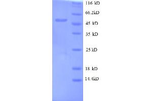 SDS-PAGE (SDS) image for Oncomodulin (OCM) (AA 26-220) protein (GST tag) (ABIN5712698) (Oncomodulin Protein (OCM) (AA 26-220) (GST tag))