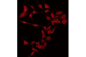 ABIN6266499 staining 293 by IF/ICC. (BAK1 抗体  (N-Term))