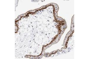 Immunohistochemical staining of human placenta with SLC19A1 polyclonal antibody  shows strong membranous positivity in trophoblastic cells at 1:200-1:500 dilution. (SLC19A1 抗体)