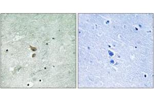 Immunohistochemistry analysis of paraffin-embedded human brain, using RIPK2 (Phospho-Ser176) Antibody. (RIPK2 抗体  (pSer176))