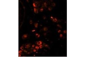 Immunofluorescence analysis of LIN28A Monoclonal Antibody with paraffin-embedded human testis tissue. (LIN28A 抗体)