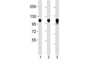 Western blot testing of Integrin alpha 7 antibody at 1:2000 dilution. (ITGA7 抗体  (C-Term))