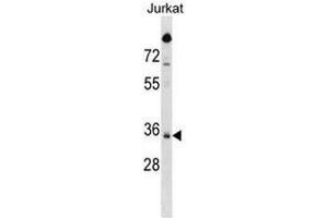 SNAPC2 Antibody (C-term) western blot analysis in Jurkat cell line lysates (35µg/lane).