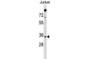 SNAPC2 Antibody (C-term) western blot analysis in Jurkat cell line lysates (35µg/lane). (SNAPC2 抗体  (C-Term))