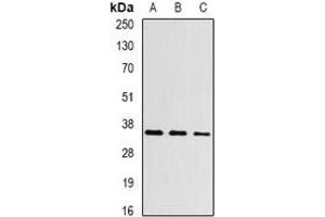 Western blot analysis of Aspartoacylase expression in Hela (A), mouse kidney (B), rat kidney (C) whole cell lysates. (ASPA 抗体)