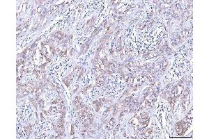 IHC analysis of CCR7 using anti-CCR7 antibody (ABIN7601362).