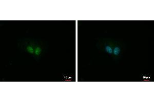 ICC/IF Image IP3KC antibody [N3C2], Internal detects IP3KC protein at nucleus by immunofluorescent analysis. (ITPKC 抗体)