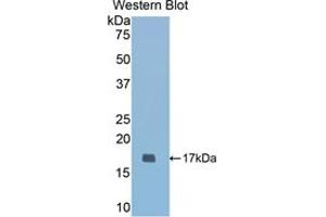 Western blot analysis of the recombinant protein. (COMP 抗体  (AA 317-455))