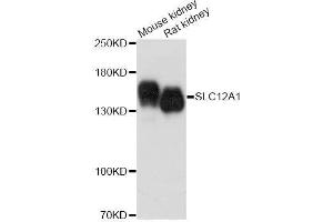 Western Blotting (WB) image for anti-Solute Carrier Family 12 (Sodium/potassium/chloride Transporters), Member 1 (SLC12A1) (AA 50-150) antibody (ABIN6147841)