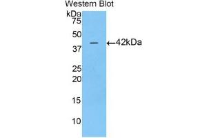 Detection of Recombinant AFP, Pig using Polyclonal Antibody to Alpha-Fetoprotein (AFP)