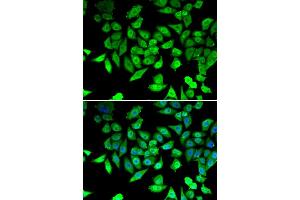 Immunofluorescence analysis of U20S cell using CCAR2 antibody. (CCAR2 抗体)