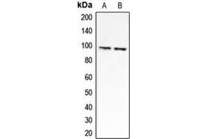 Western blot analysis of CLCN6 expression in HEK293A (A), Jurkat (B) whole cell lysates. (CLCN6 抗体  (Center))
