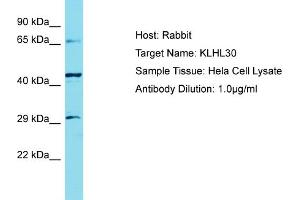 Host: Rabbit Target Name: KLHL30 Sample Tissue: Human Hela Whole Cell Antibody Dilution: 1ug/ml (KLHL30 抗体  (C-Term))