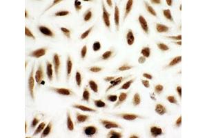 Immunocytochemistry (ICC) image for anti-Nucleoside diphosphate kinase B (NME2) (AA 137-152) antibody (ABIN3032112)