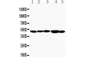 Anti-TIM 1 antibody, Western blotting Lane 1: SMMC Cell Lysate Lane 2: HELA Cell Lysate Lane 3: PANC Cell Lysate Lane 4: MM231 Cell Lysate Lane 5: MM453 Cell Lysate (HAVCR1 抗体  (C-Term))