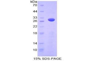 SDS-PAGE analysis of Mouse PRKAg2 Protein. (PRKAG2 蛋白)