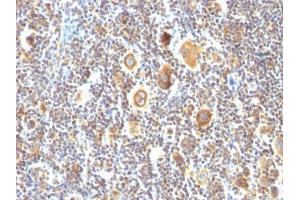 Image no. 2 for anti-B-Cell CLL/lymphoma 6 (BCL6) antibody (ABIN6175703) (BCL6 抗体)