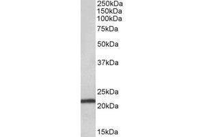 Western Blotting (WB) image for anti-Transmembrane Protein 205 (TMEM205) (Internal Region) antibody (ABIN2464767) (TMEM205 抗体  (Internal Region))