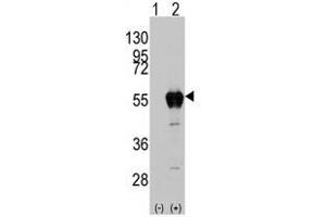 Image no. 2 for anti-Aldehyde Dehydrogenase 2 Family (Mitochondrial) (ALDH2) (AA 325-355) antibody (ABIN356918) (ALDH2 抗体  (AA 325-355))