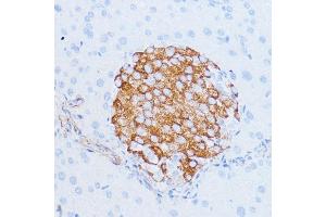 Immunohistochemistry of paraffin-embedded mouse pancreas using NOTCH3 antibody (ABIN6134401, ABIN6144738, ABIN6144739 and ABIN6217553) at dilution of 1:100 (40x lens). (NOTCH3 抗体  (C-Term))