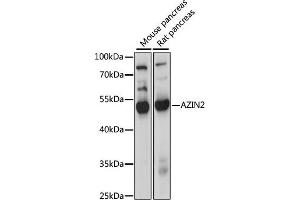 Western blot analysis of extracts of various cell lines, using  antibody (ABIN7265663) at 1000 dilution. (ADC 抗体  (AA 1-360))