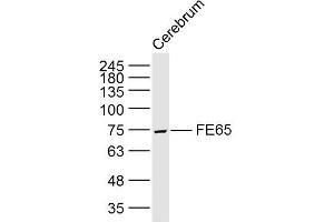 Lane 1: Rat cerebrum lysates probed with FE65 Polyclonal Antibody, Unconjugated (bs-0110R) at 1:300 overnight at 4˚C. (FE65 抗体  (AA 201-300))