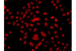 Immunofluorescence analysis of A549 cells using FBXW11 antibody (ABIN5975739). (FBXW11 抗体)
