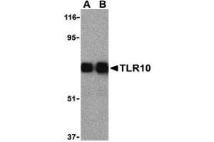 Western Blotting (WB) image for anti-Toll-Like Receptor 10 (TLR10) (Middle Region) antibody (ABIN1031128) (TLR10 抗体  (Middle Region))