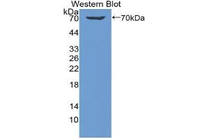 Western blot analysis of the recombinant protein. (KIR2DL1 抗体  (AA 22-348))