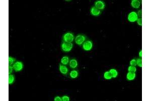 Image no. 2 for anti-Checkpoint Kinase 2 (CHEK2) antibody (ABIN1497496) (CHEK2 抗体)