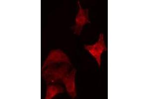 ABIN6279792 staining HepG2 cells by IF/ICC. (Septin 5 抗体  (Internal Region))