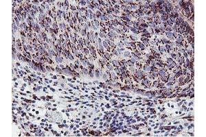 Image no. 2 for anti-Golgi Membrane Protein 1 (GOLM1) antibody (ABIN1498491) (GOLM1 抗体)