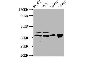Western Blot Positive WB detected in: HepG2 whole cell lysate, PC-3 whole cell lysate, Rat liver tissue, Mouse liver tissue All lanes: E2F5 antibody at 5 μg/mL Secondary Goat polyclonal to rabbit IgG at 1/50000 dilution Predicted band size: 38, 21 kDa Observed band size: 38 kDa (E2F5 抗体  (AA 193-298))