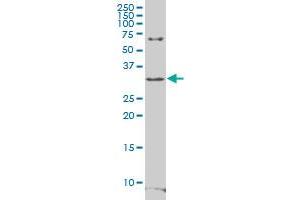 RFPL4B polyclonal antibody (A01), Lot # 060703JCS1. (RFPL4B 抗体  (AA 127-226))