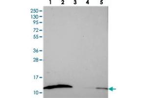 Western blot analysis of Lane 1: RT-4, Lane 2: U-251 MG, Lane 3: Human Plasma, Lane 4: Liver, Lane 5: Tonsil with S100A16 polyclonal antibody  at 1:250-1:500 dilution.