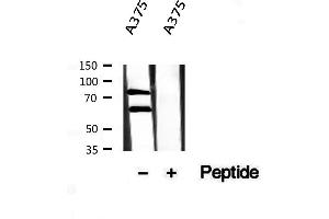 Western blot analysis of extracts from A375, using Melanophilin antibody. (Melanophilin 抗体  (C-Term))